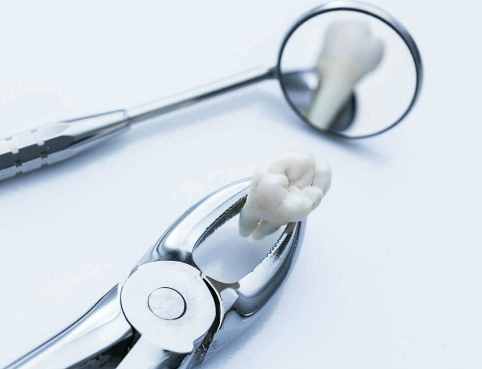 Удаление зубов 